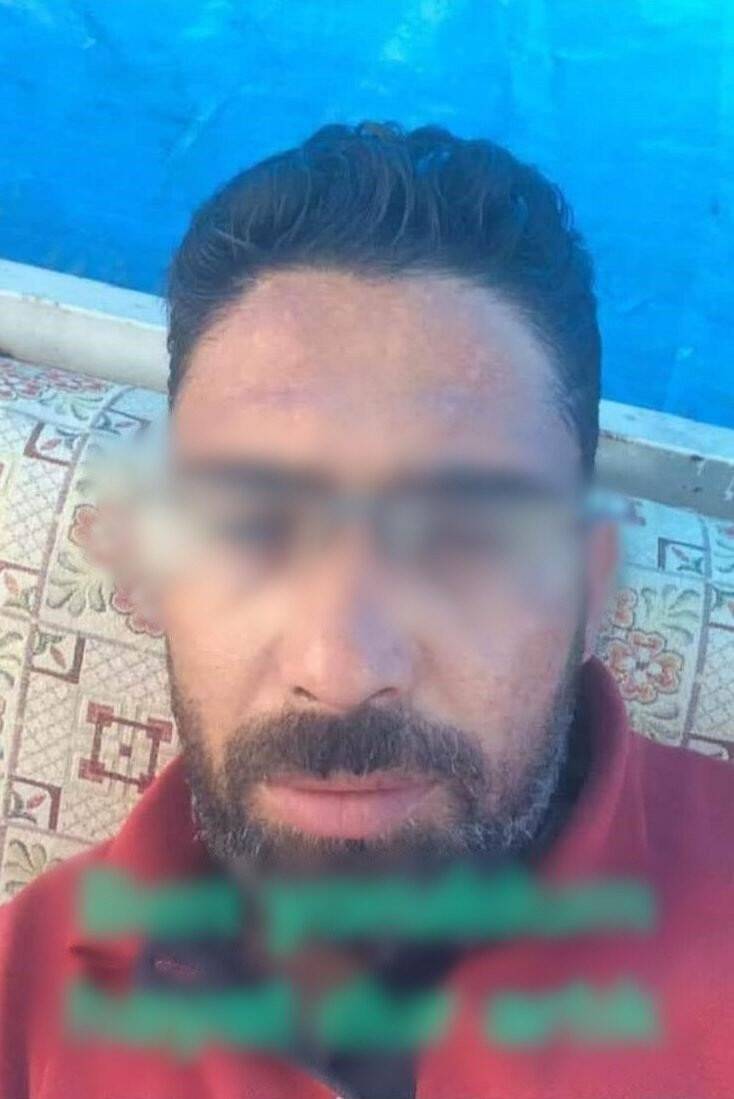 Bahçesindeki kuru ağacı taşlama makinesiyle budarken boğazını kesti