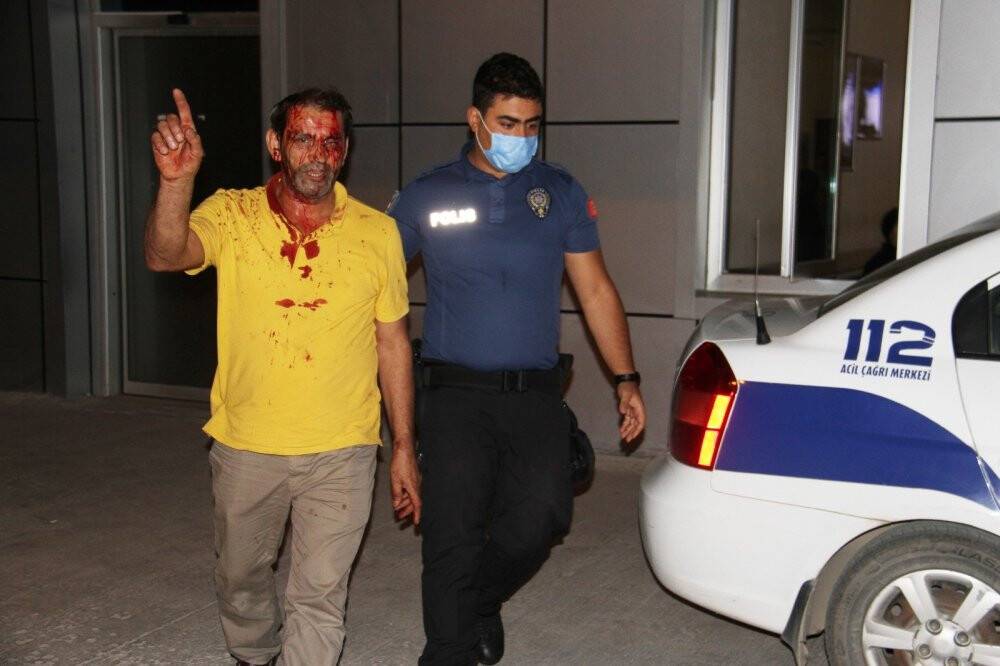 Kavgaya müdahale eden polisin ayağını otomobil ezdi