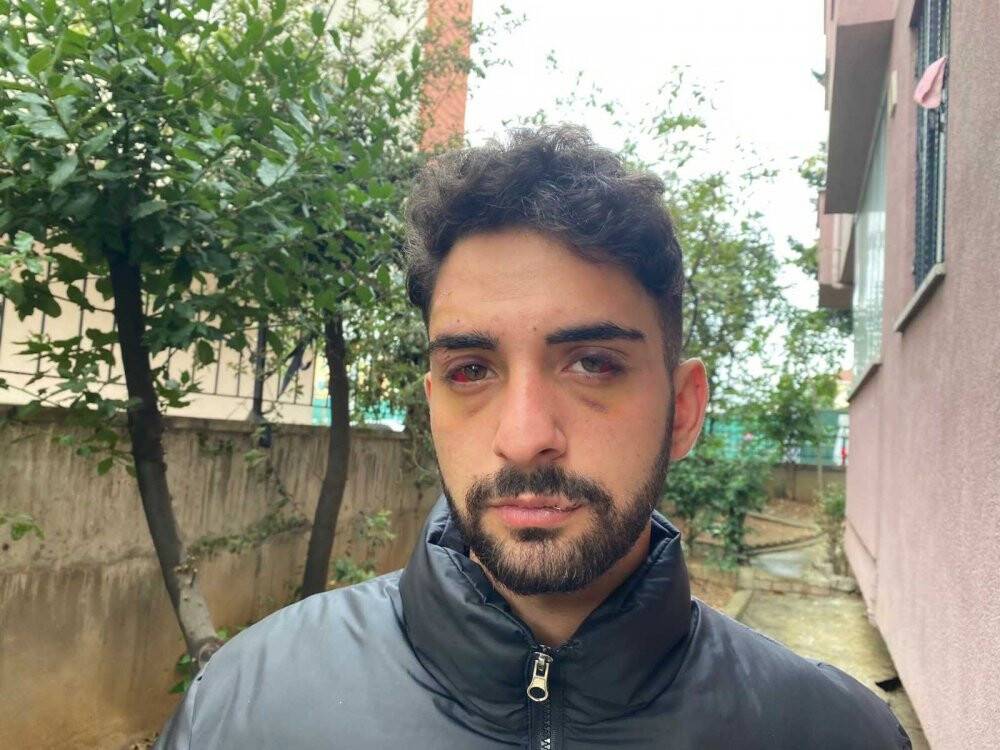 'Korna çaldın’ dayağı kamerada