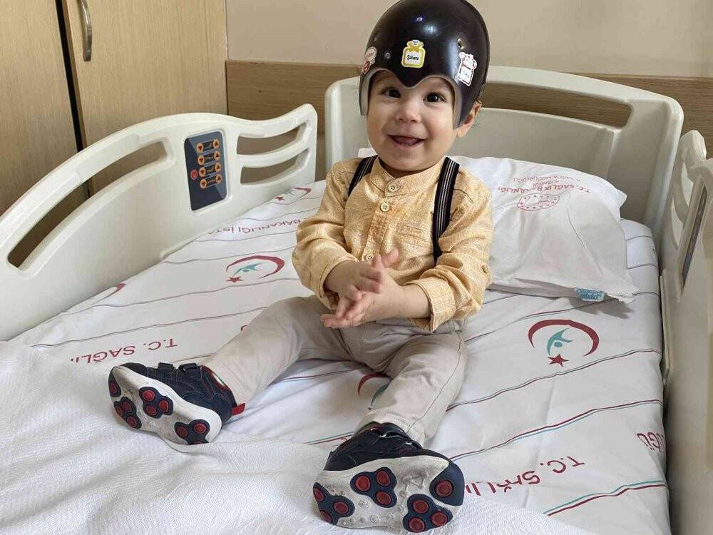 Bebeklerde kafatası şekil bozukluğuna dikkat!