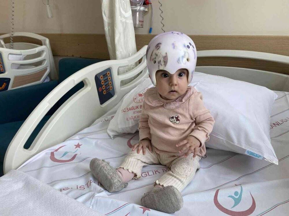 Bebeklerde kafatası şekil bozukluğuna dikkat!