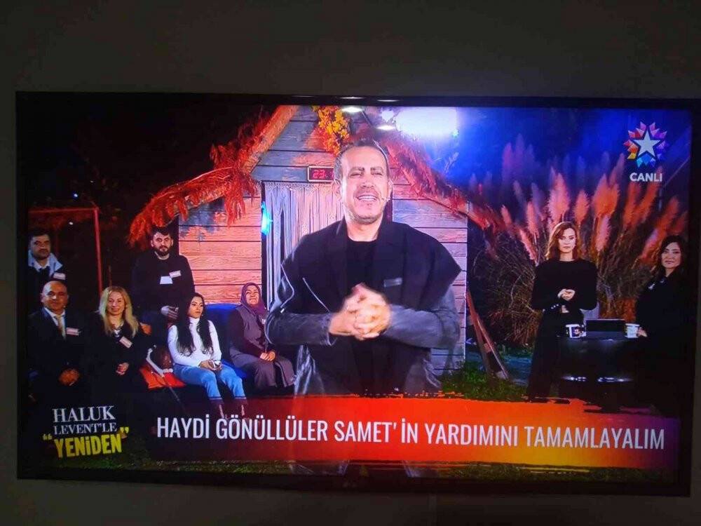 Samet, protez kollarına kavuşuyor