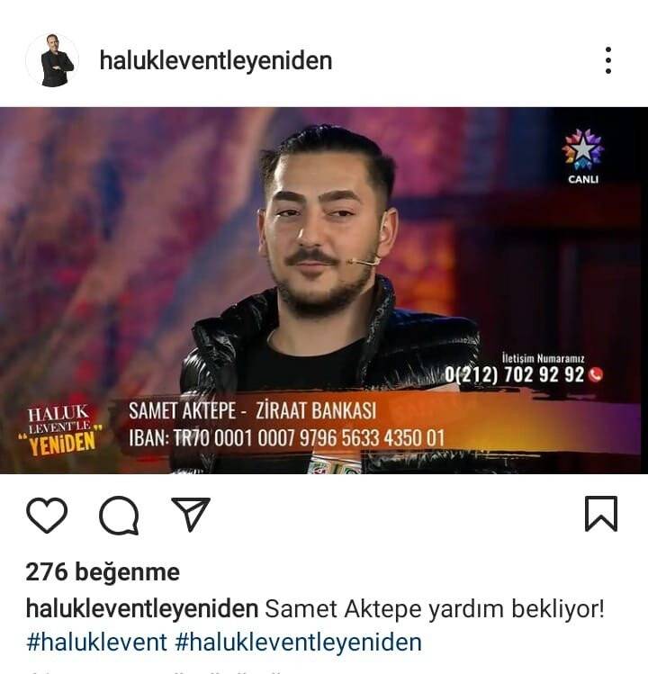 Samet, protez kollarına kavuşuyor