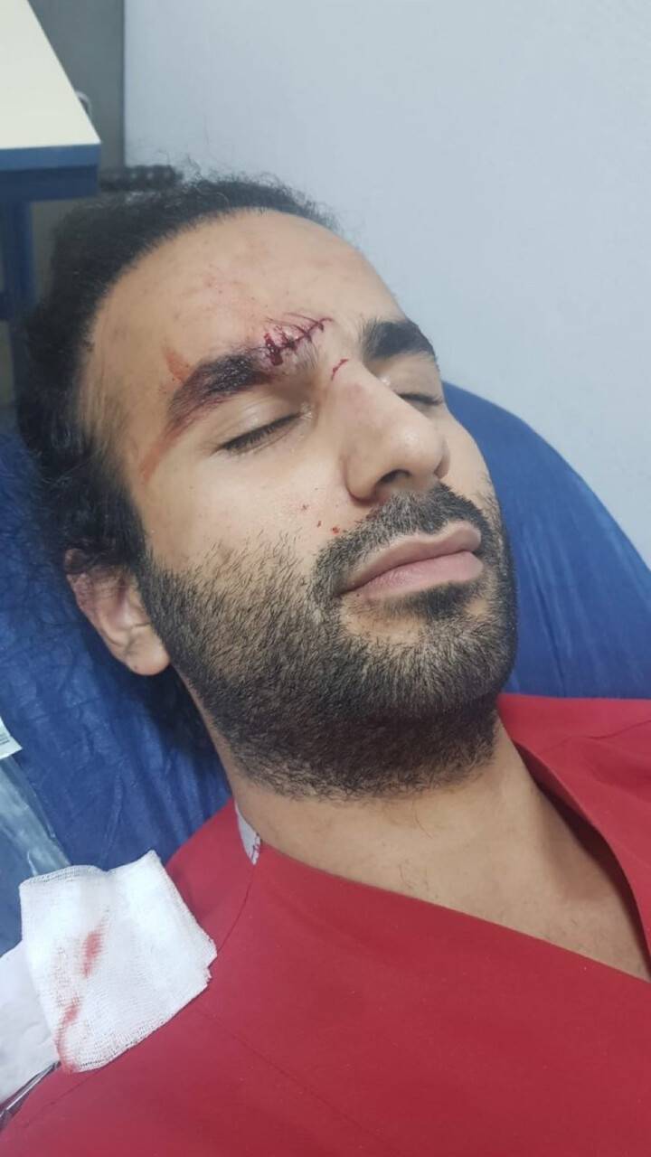 Didim’deki saldırgan, gözaltına alındı