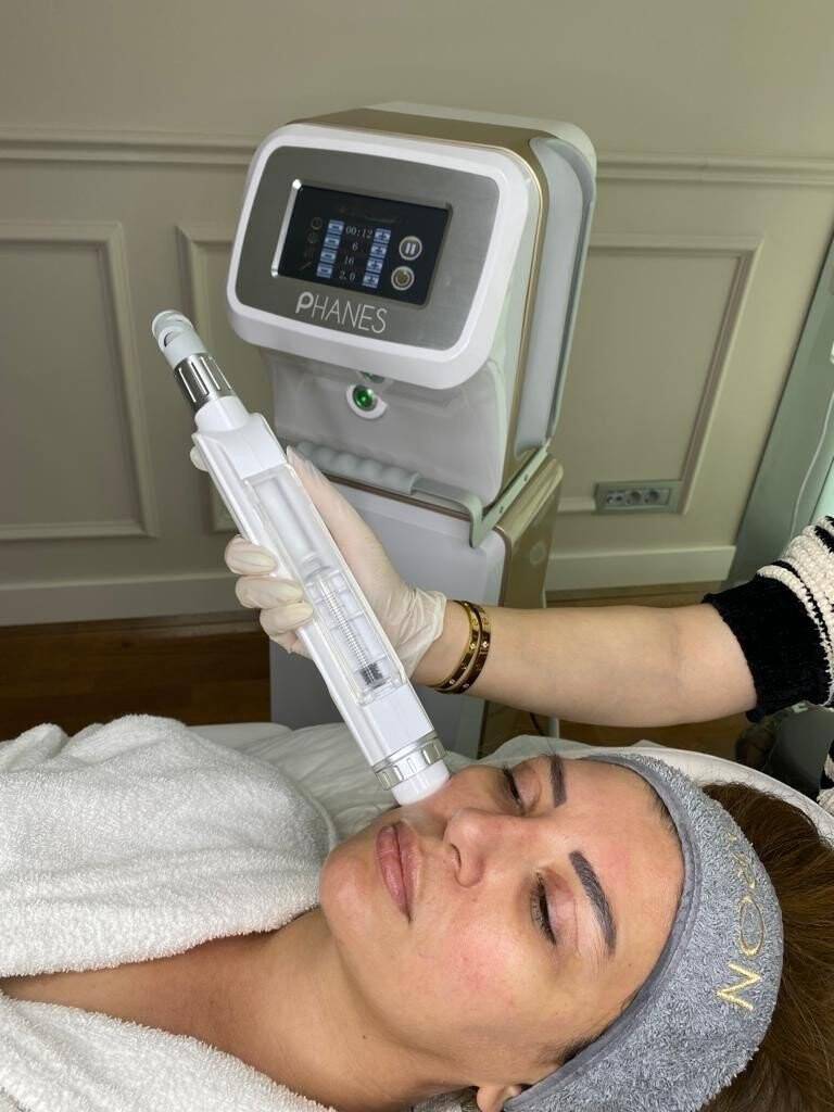 Avrupa’nın güzelliği Türklere emanet