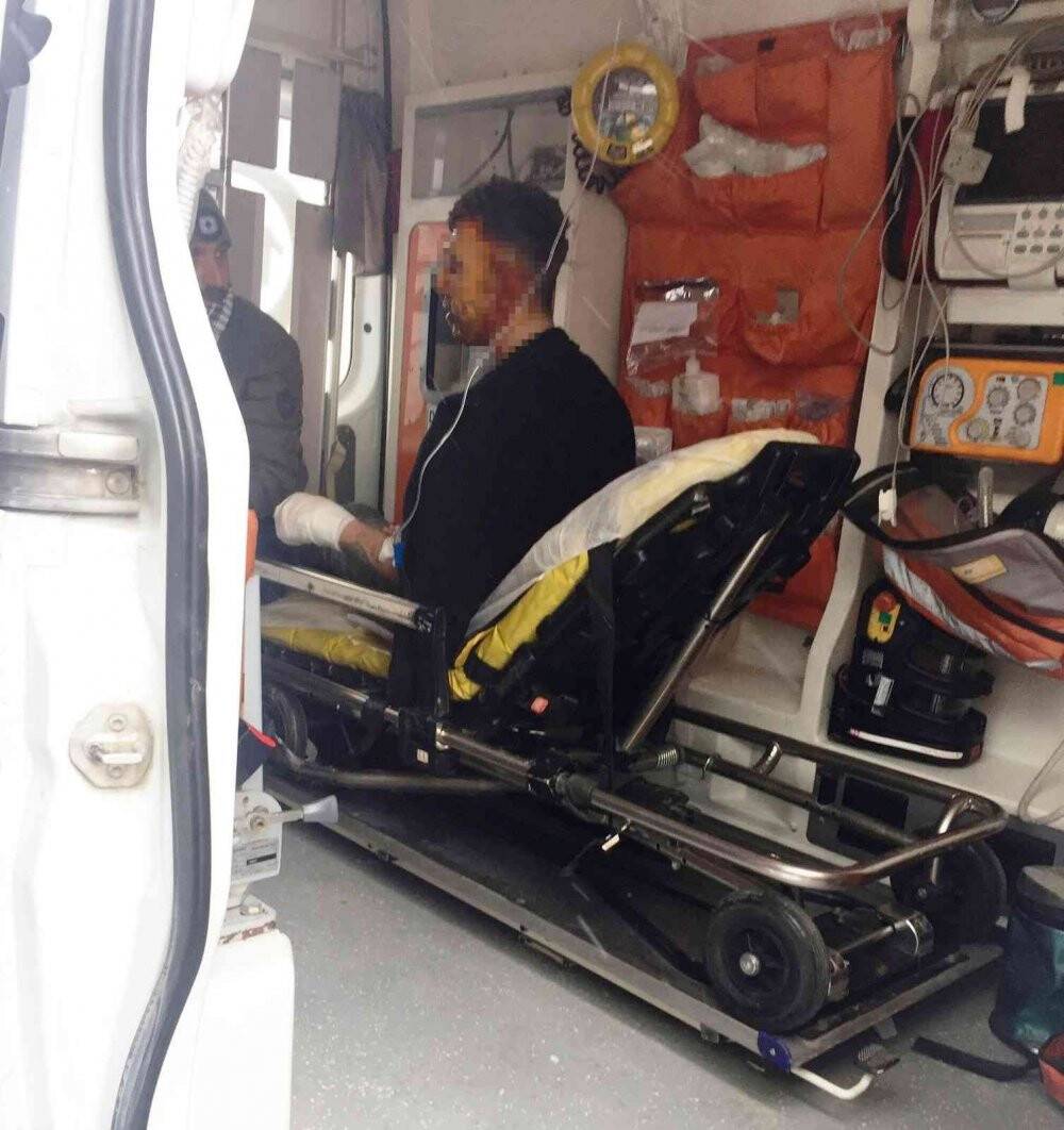 Tinerle sobayı tutuşmak isterken kendini yaktı