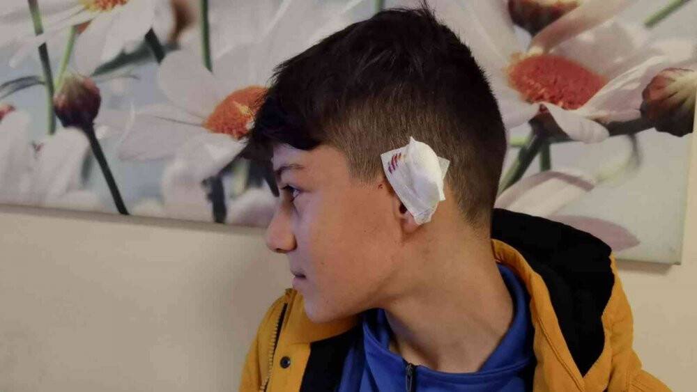 Başıboş köpek kartopu oynayan gence saldırdı