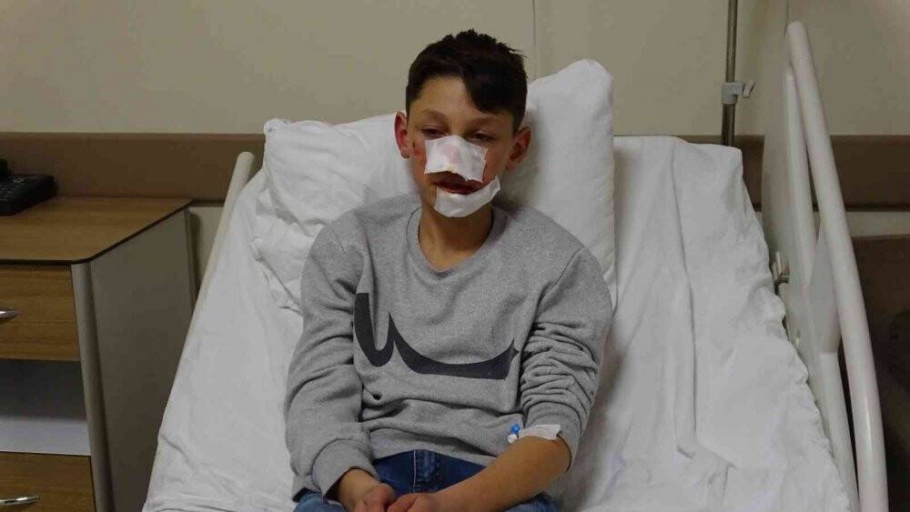 Köpek saldırısı ekmek almaya giden çocuğa dehşeti yaşattı