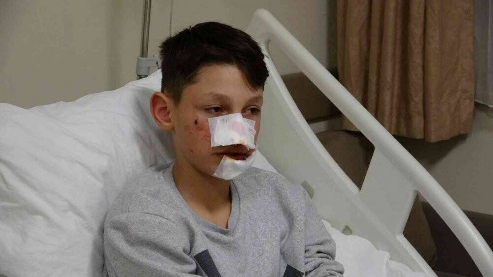 Köpek saldırısı ekmek almaya giden çocuğa dehşeti yaşattı