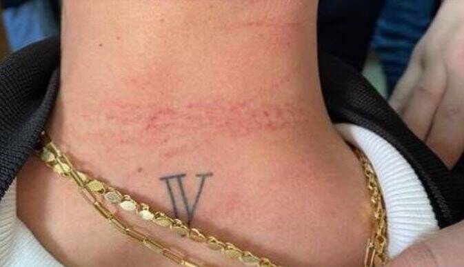 Doktora saldıran şüpheli gözaltına alındı