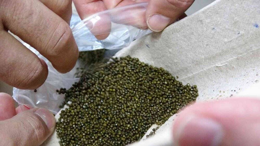 Safra kesesinden çıkanlarla Guinness’e başvuru yapacak