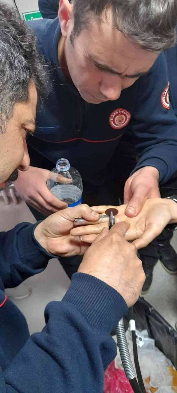 Parmağa sıkışan yüzüğü itfaiye ekipleri çıkardı