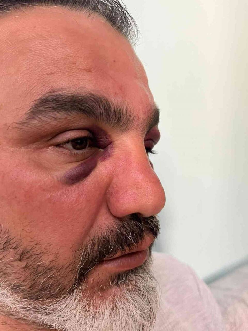 Eşinin memleketini tanımak isteyen gurbetçi, trafik magandalarının kurbanı oldu