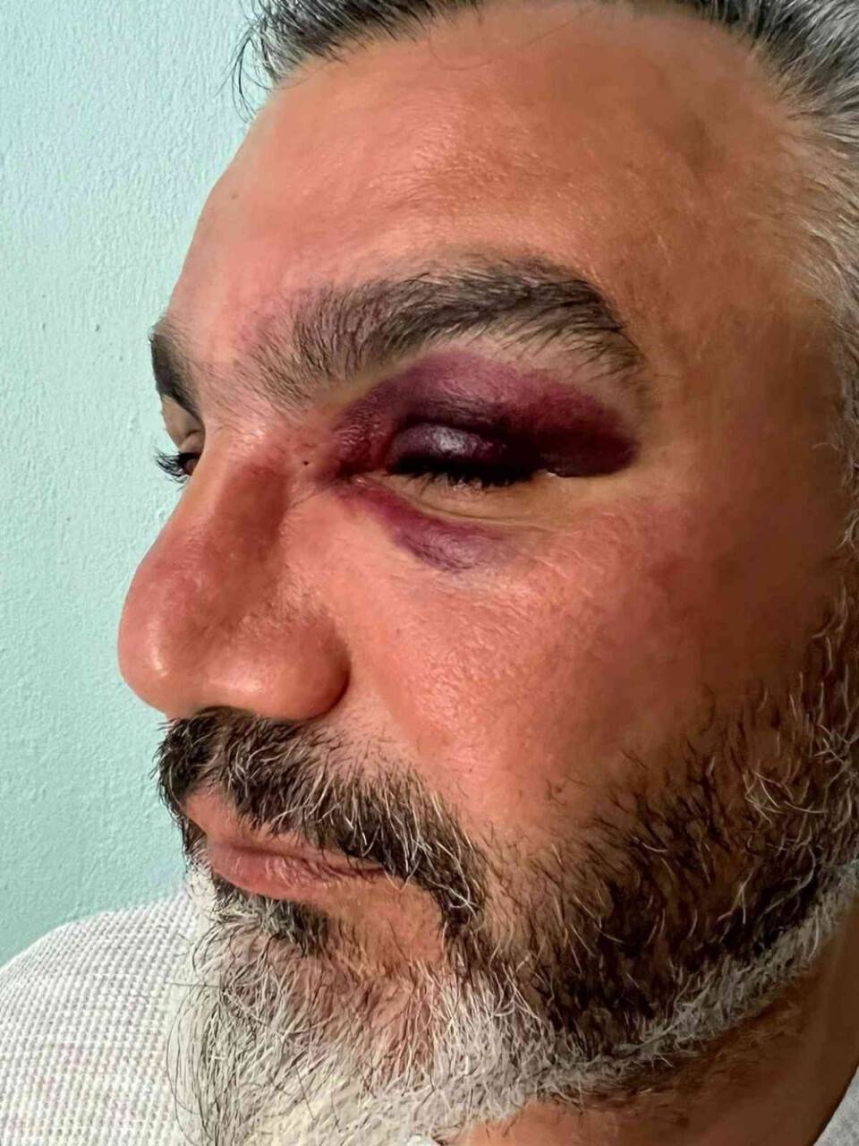 Eşinin memleketini tanımak isteyen gurbetçi, trafik magandalarının kurbanı oldu