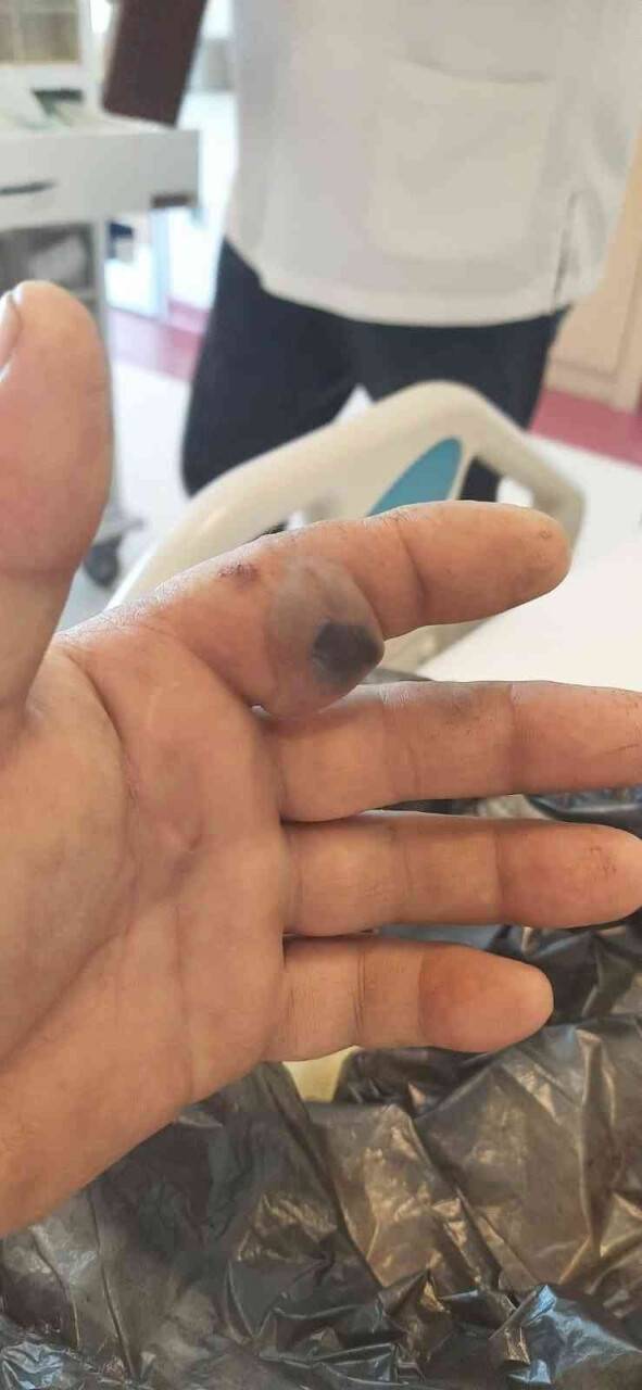 Elini sokan yılanla hastaneye koştu