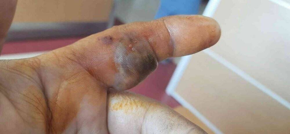 Elini sokan yılanla hastaneye koştu