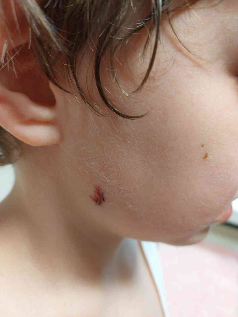 Sahipsiz köpekler 5 yaşındaki çocuğa saldırdı