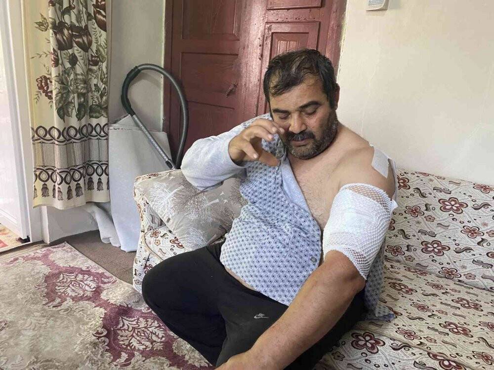 Ayı saldırısına uğrayan vatandaş: 'Beni öldü zannetti'