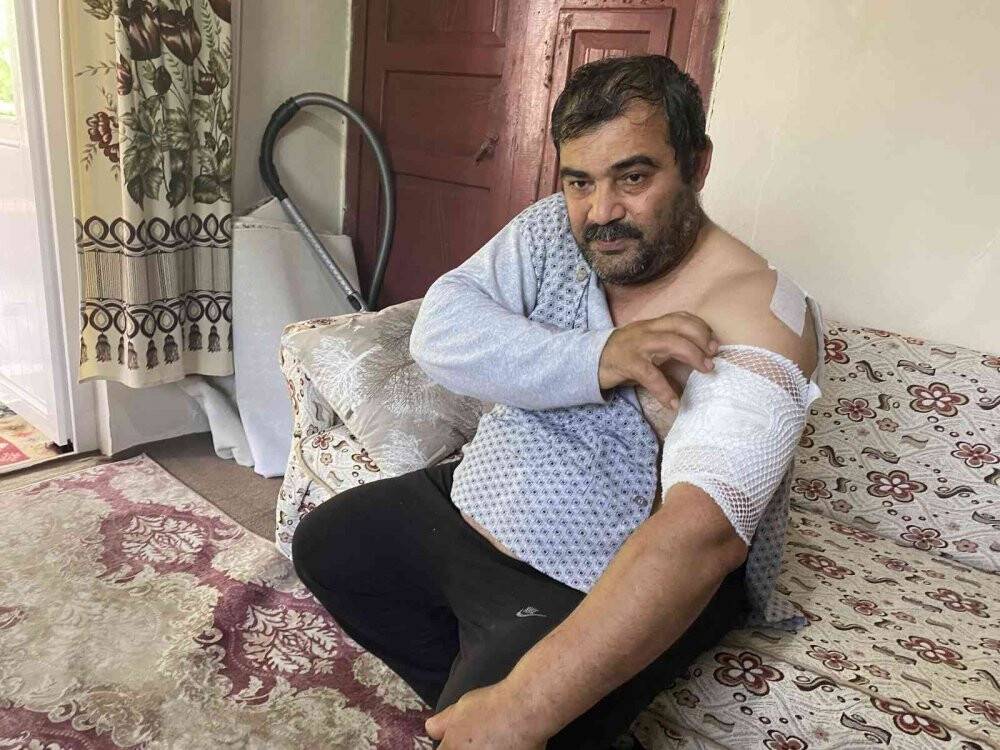 Ayı saldırısına uğrayan vatandaş: 'Beni öldü zannetti'