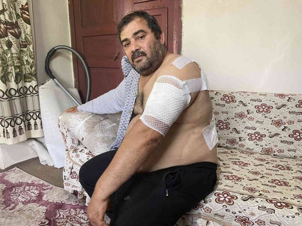 Ayı saldırısına uğrayan vatandaş: 'Beni öldü zannetti'