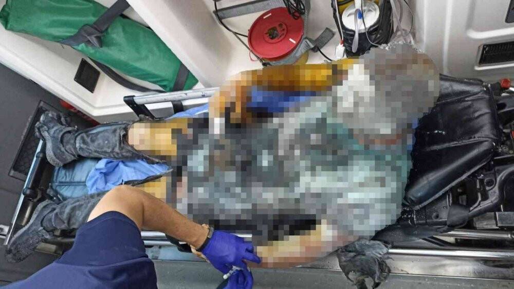 Oraklı genç tinerle kendini yaktı