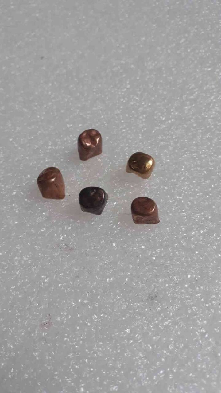 Sahte altın dişlerle kuyumcuyu dolandırdı