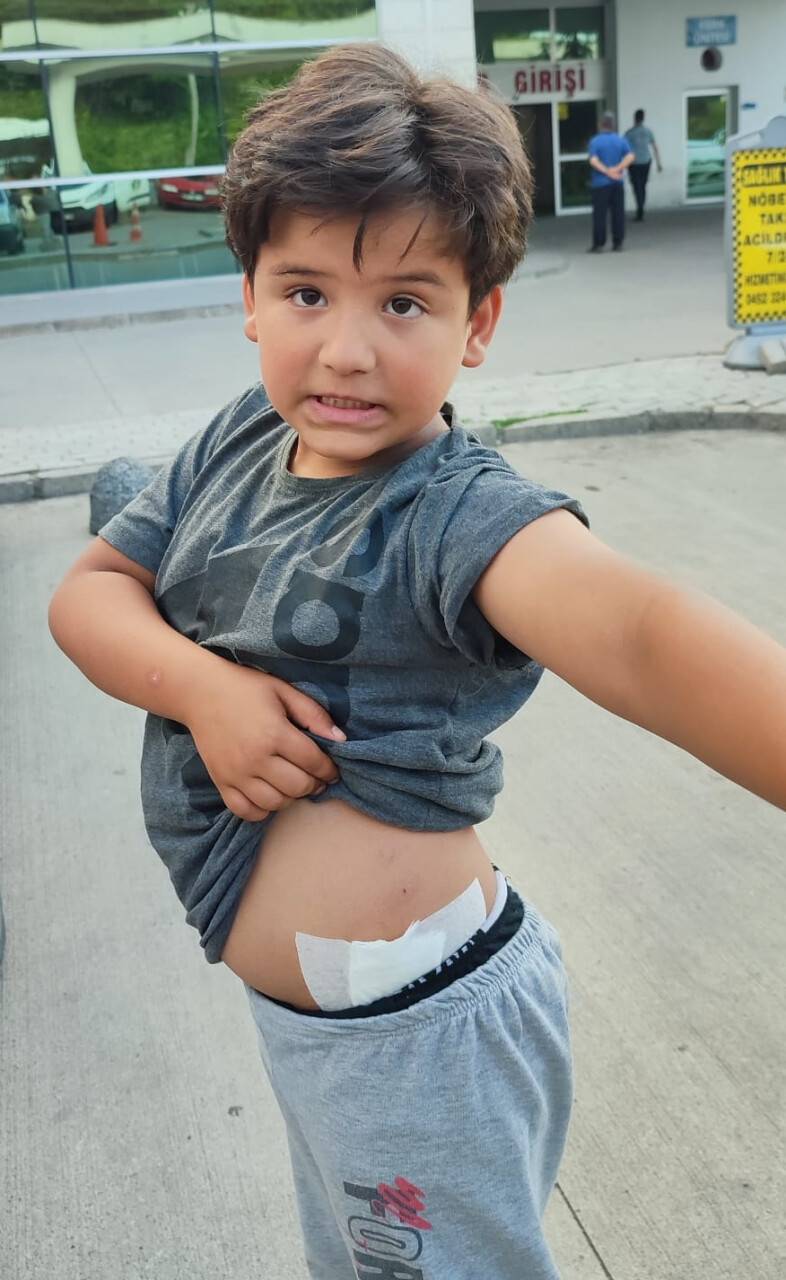 aa-20220615-28170277-28170276-sevmek-istedigi-kopegin-saldirisina-ugrayan-cocuk-yaralandi-1.jpg