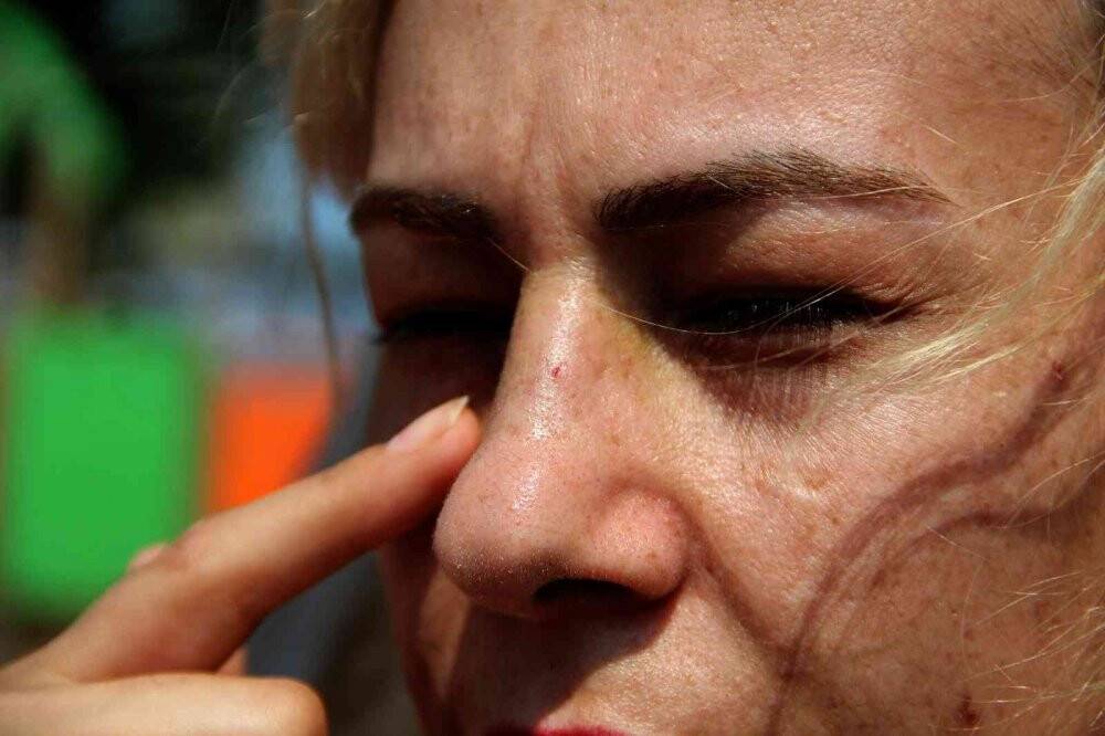 Çakmak istediler, darp ettiler