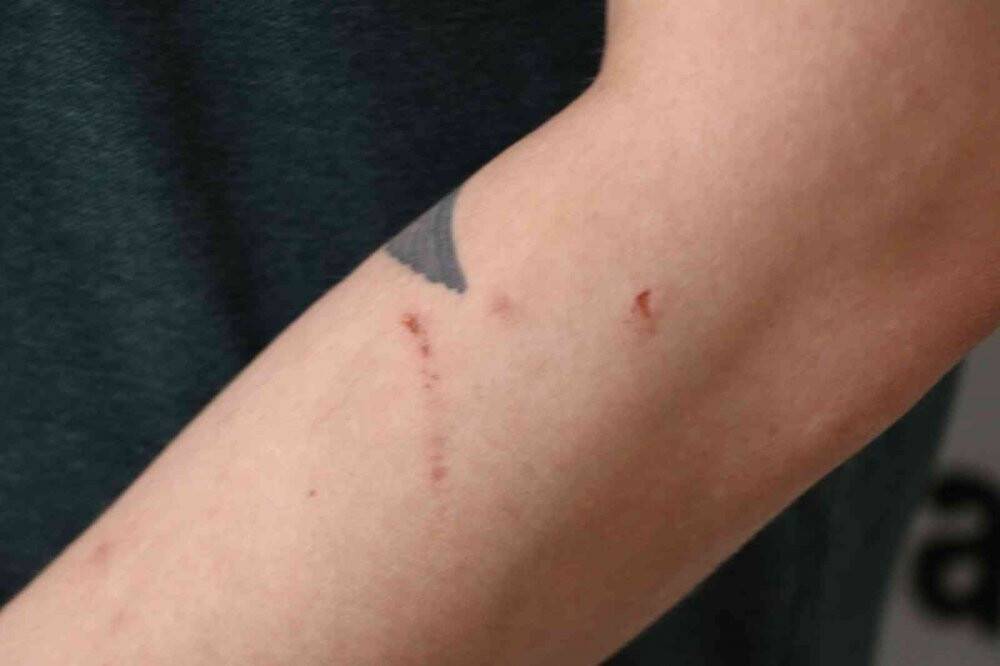 Yaşadığı dehşeti anlatan doktor, diplomasını neden yırttığını açıkladı