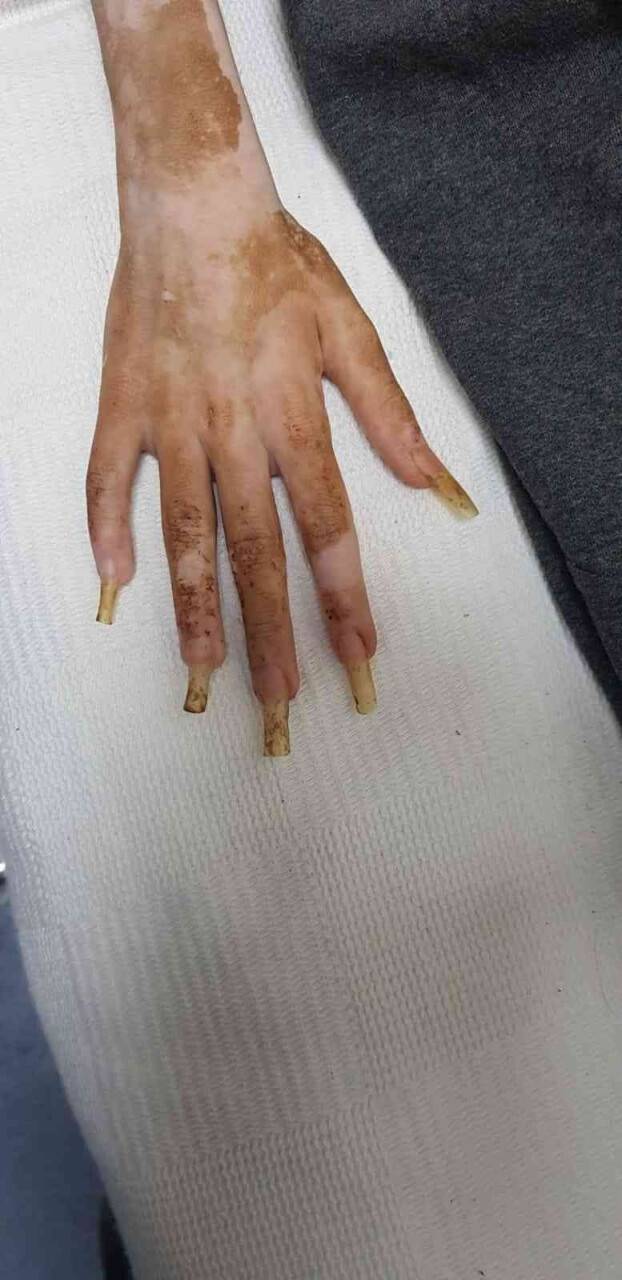 Çöp evde kilitli bulunan çocuk sosyal hizmetlere teslim edildi