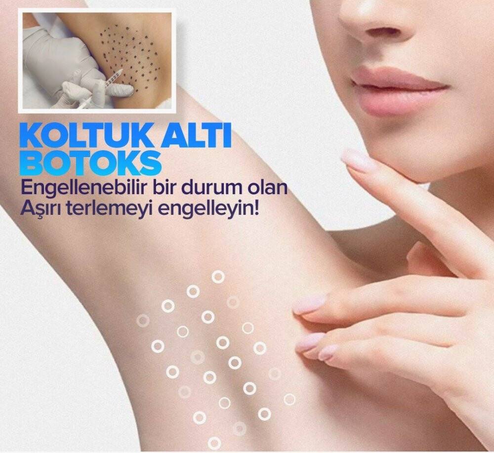 Sosyal yaşantıyı ve öz güveni negatif etkileyen aşırı terleme botoks ile tedavi edilebiliyor