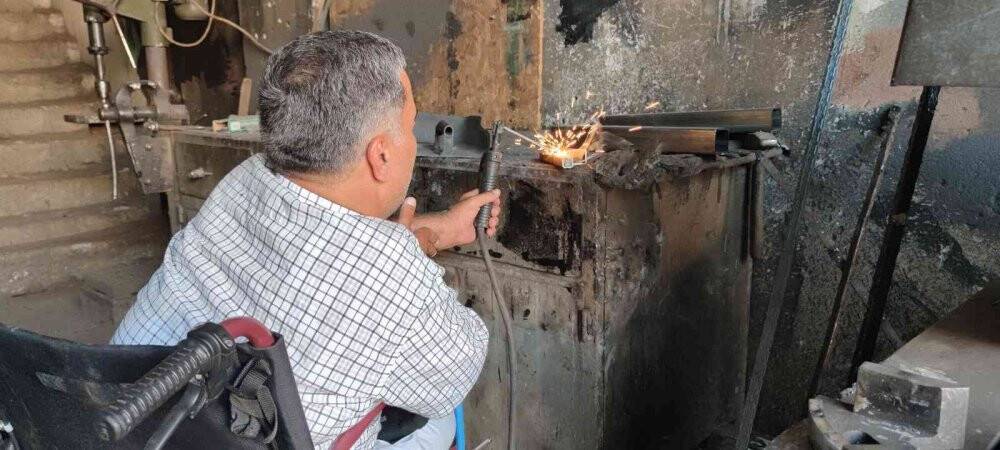 Depremde henüz 40 günlükken 2 bacağını kaybetti, yaşama azmini kaybetmedi