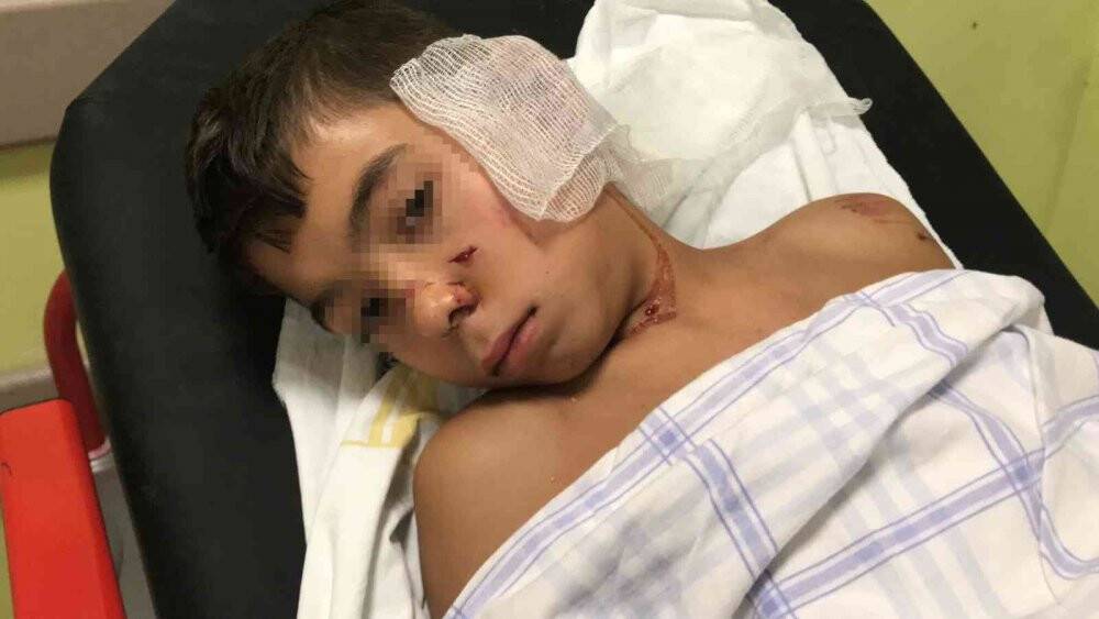 Sahipsiz köpeklerin dehşeti yaşattığı çocuğun annesi: "Kanlar içinde yatıyordu"