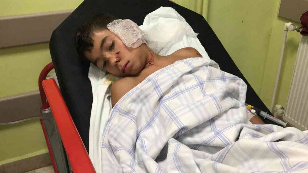 Sahipsiz köpeklerin dehşeti yaşattığı çocuğun annesi: "Kanlar içinde yatıyordu"