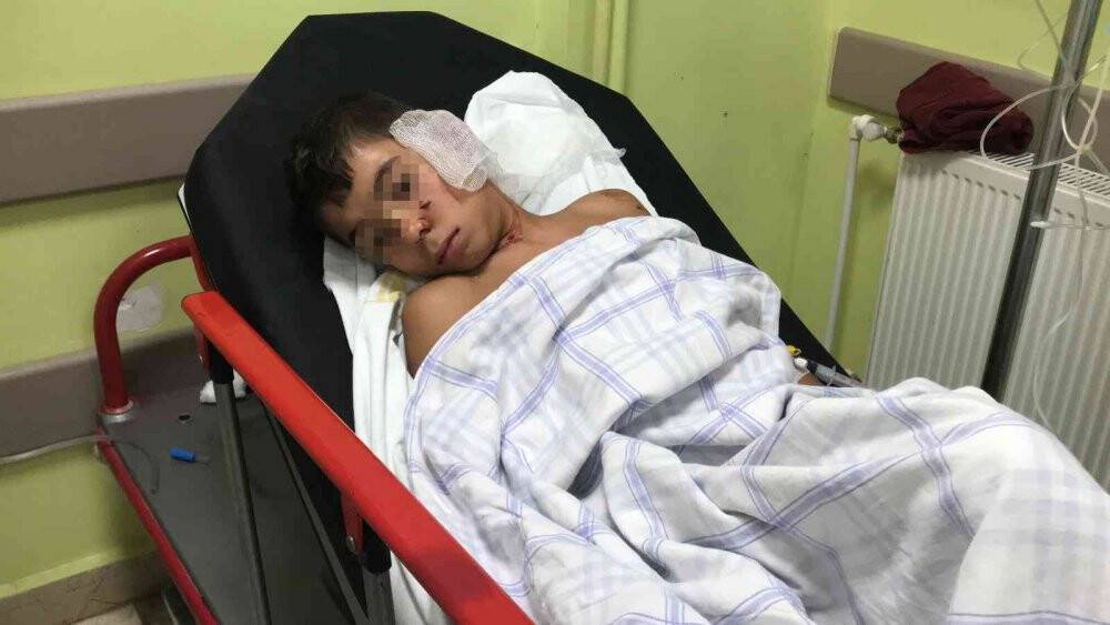 Sahipsiz köpeklerin dehşeti yaşattığı çocuğun annesi: "Kanlar içinde yatıyordu"