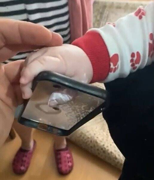 Minik bebeğin parmağı öyle bir yere sıkıştı ki gören şaşkına döndü