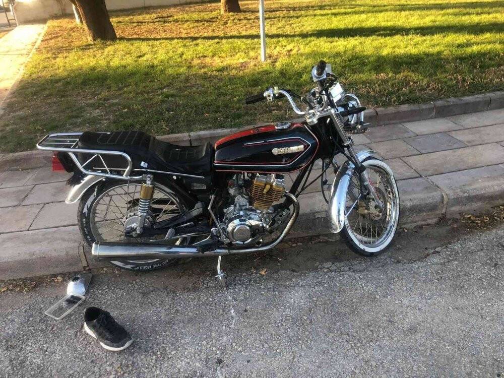 Otomobile çarpan motosiklet sürücüsünün bir ayağı parçalandı