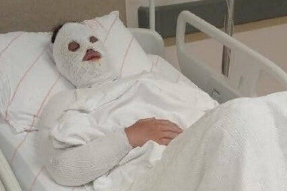 Konya'daeski nişanlısına kimyasal sıvı atan kişinin iddianamesi kabul edildi