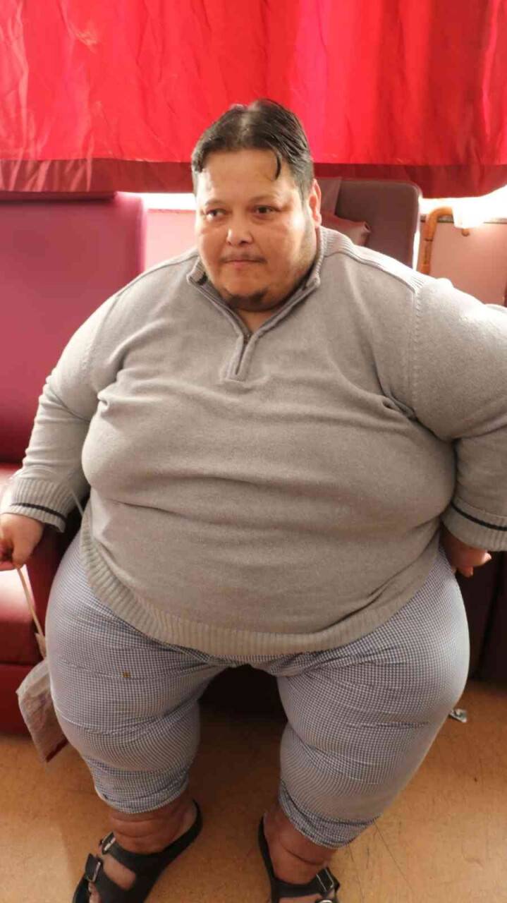 Artık yürüyemeyecek hale geldi, tüp mide ameliyatıyla kilolarından kurtulacak