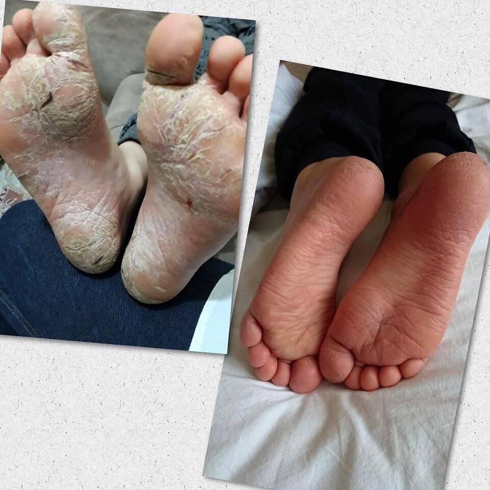 Çalıntısı şifa değil tehlike saçıyor