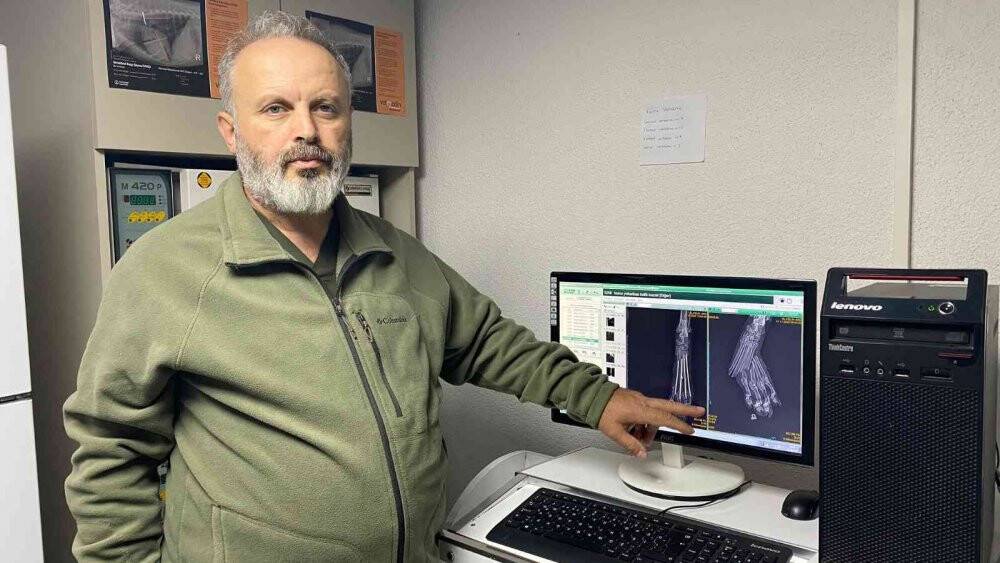 Otomobilin çarptı parmakları kırıldı