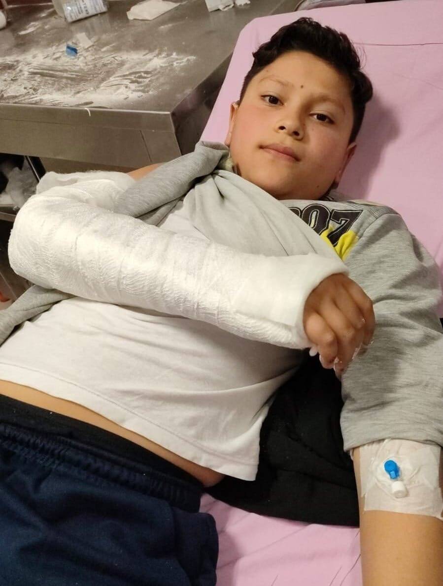 Başıboş köpekten kaçarken canından oluyordu