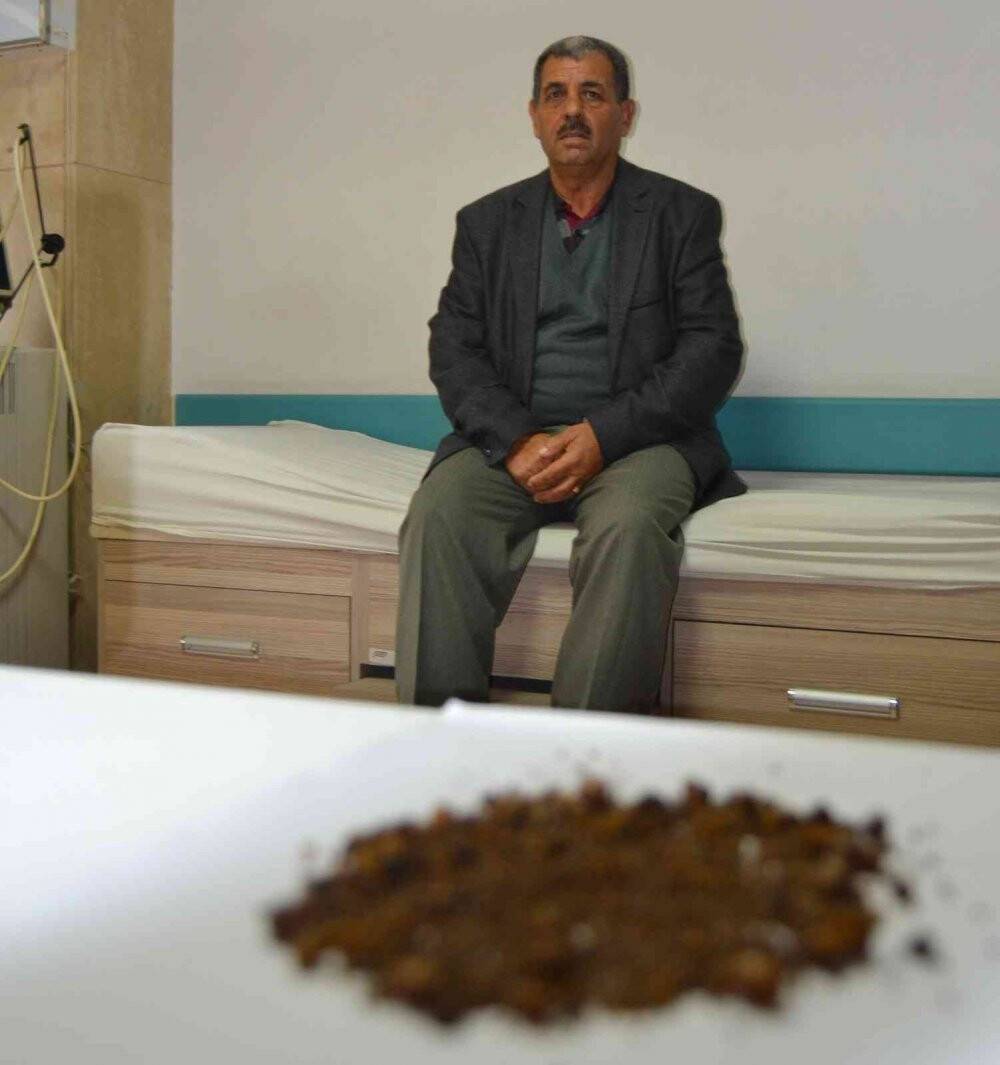 Safra kesesi değil sanki taş ocağı