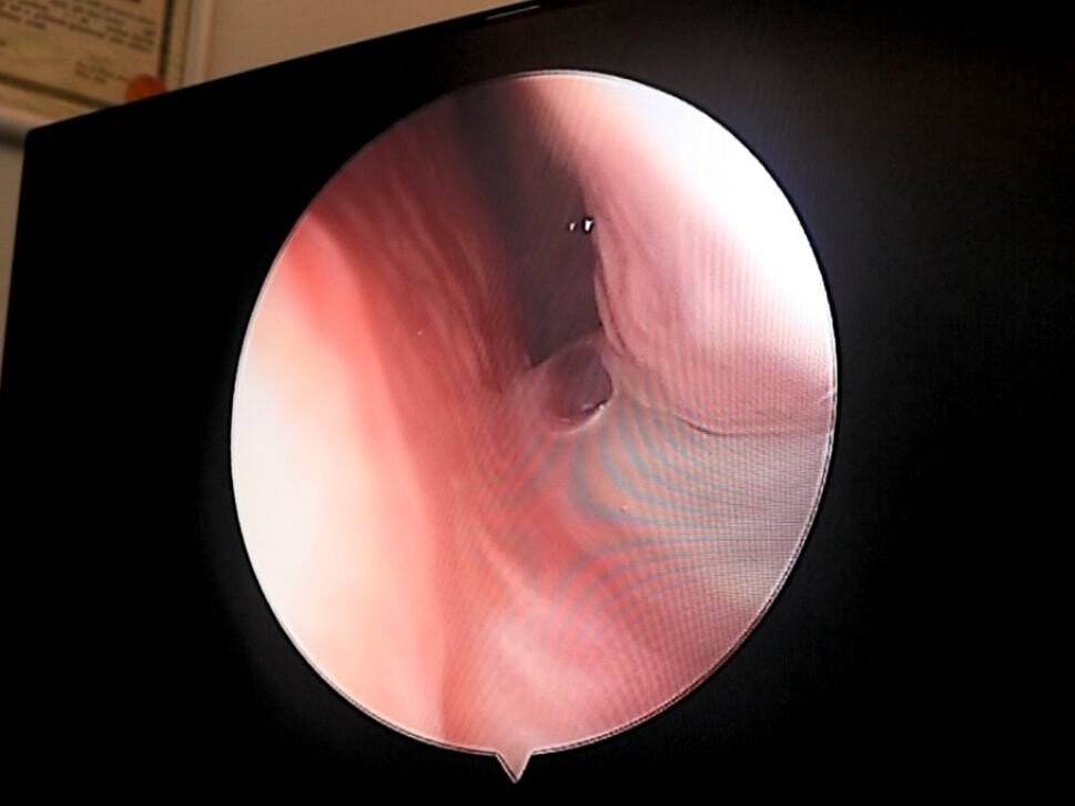 Geçmeyen gribin nedeni bulundu