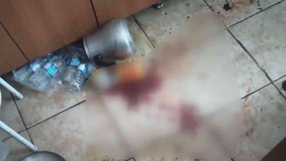 Davalı yeğeni kafa derisini yüzdü