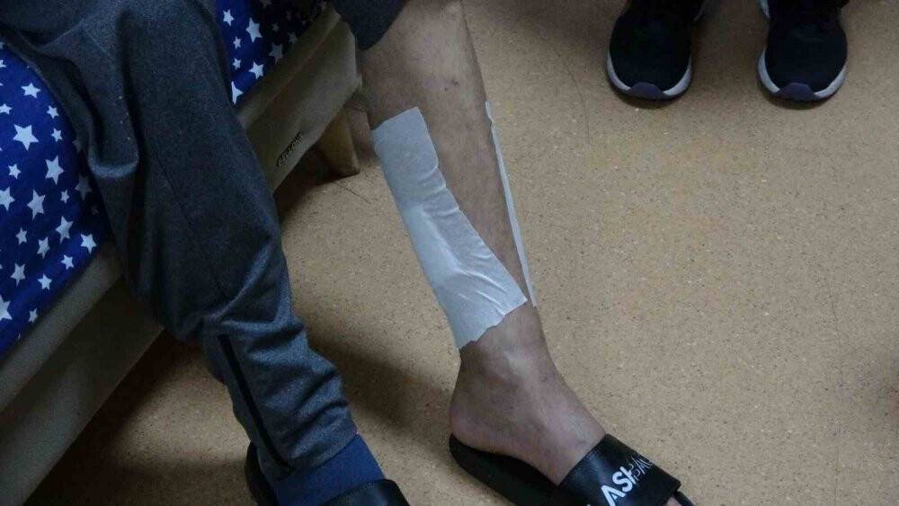 Kaval kemiğinden çene yapılan hasta sağlığına kavuştu