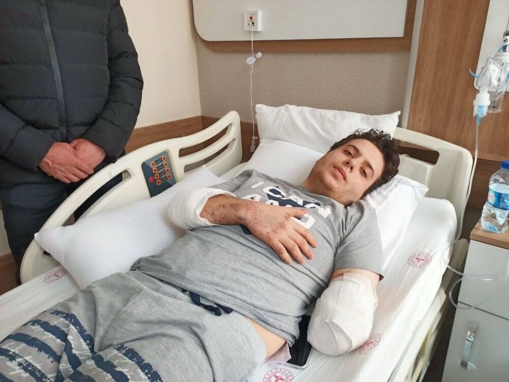 Ailesini ve sol kolunu kaybetti