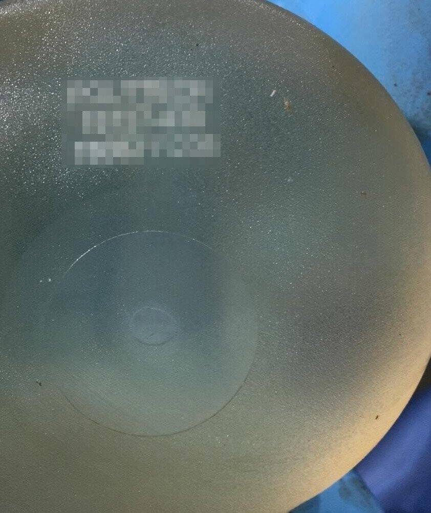 Kesik baş cinayetinde yeni gelişme