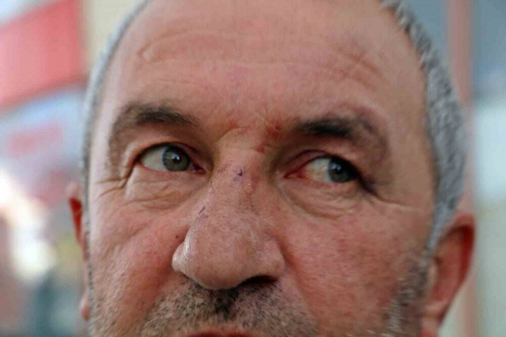 Kulak zarını patlatana kadar dövdüler: ‘Bu değilmiş’ deyip gittiler