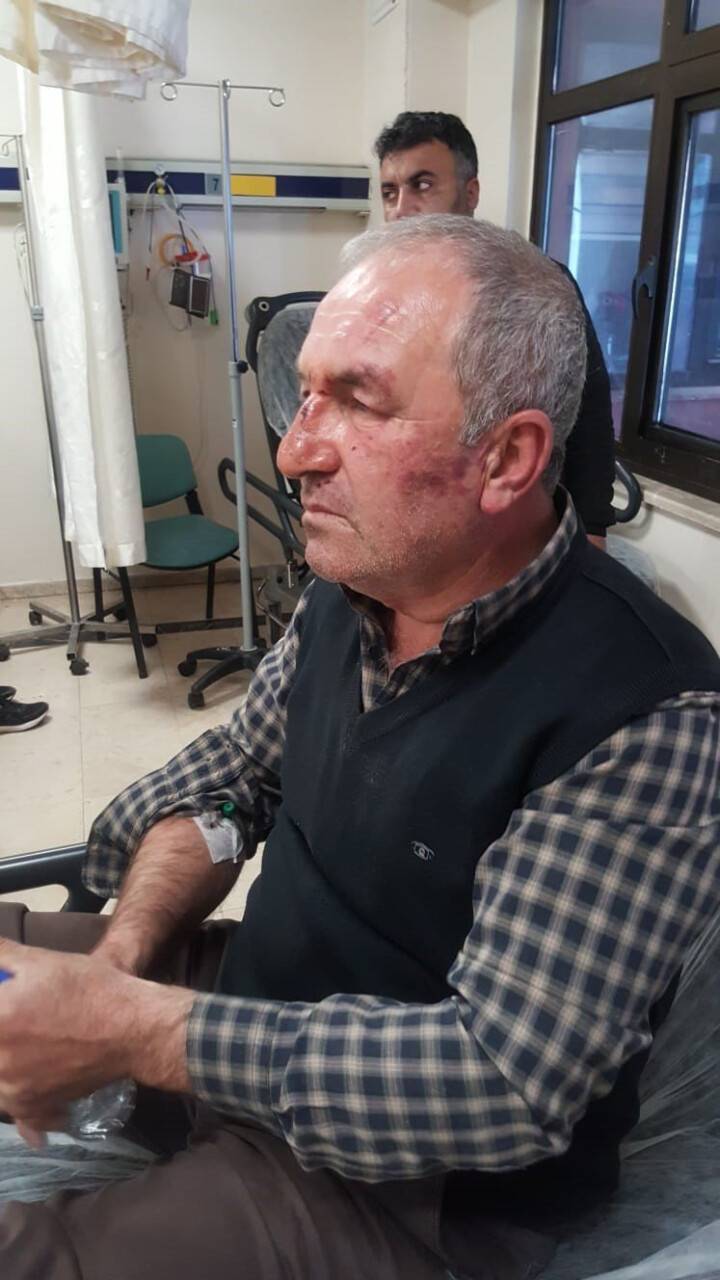 Kulak zarını patlatana kadar dövdüler: ‘Bu değilmiş’ deyip gittiler